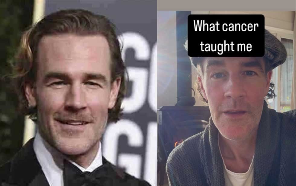 Subasta James Van Der Beek objetos para tratar su cáncer